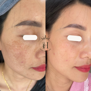 Những hoạt chất hỗ trợ cải thiện cho làn da tuổi 25-45 hiệu quả