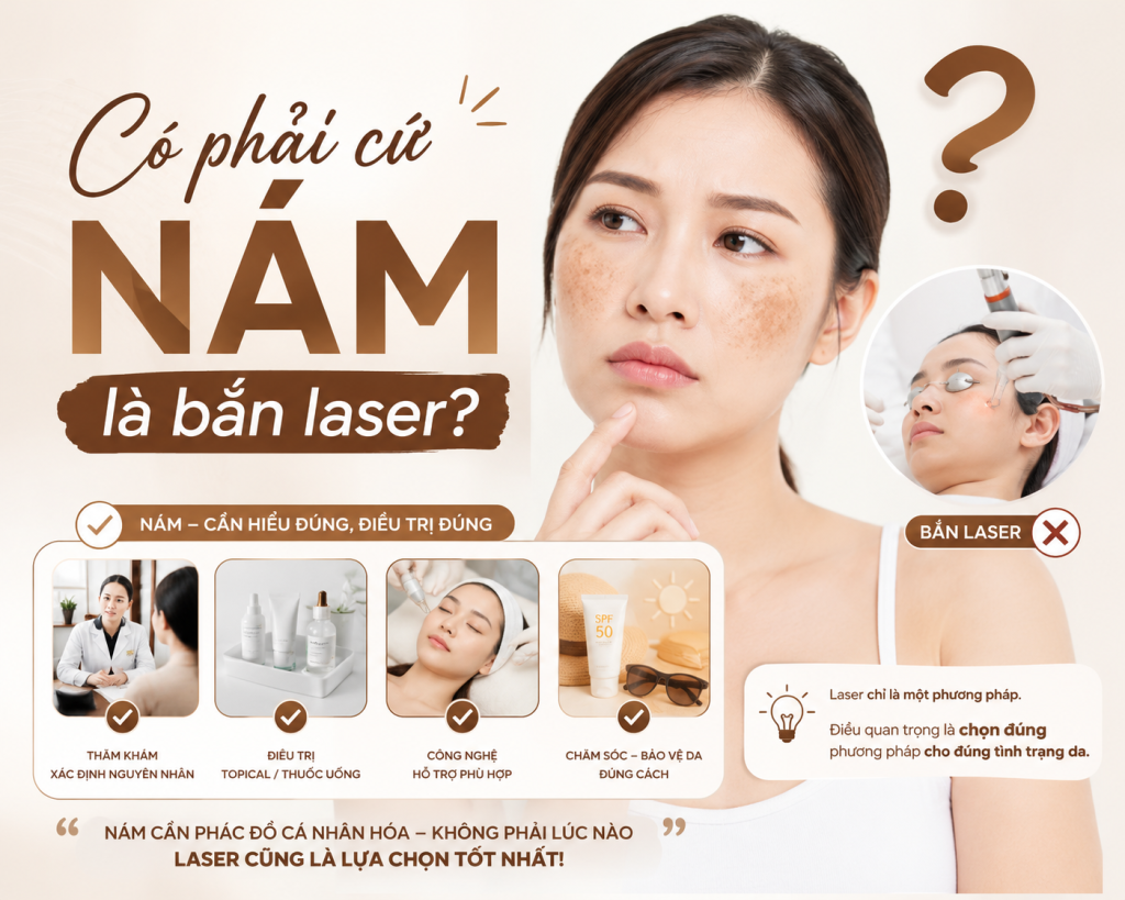 Có phải cứ nám má là chúng ta sử dụng laser để xử lý hay không?