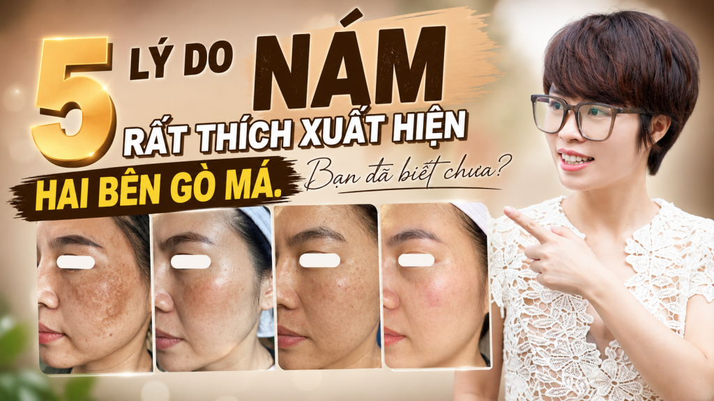 5 lý do NÁM rất thích xuất hiện hai bên gò má. Bạn đã biết chưa?
