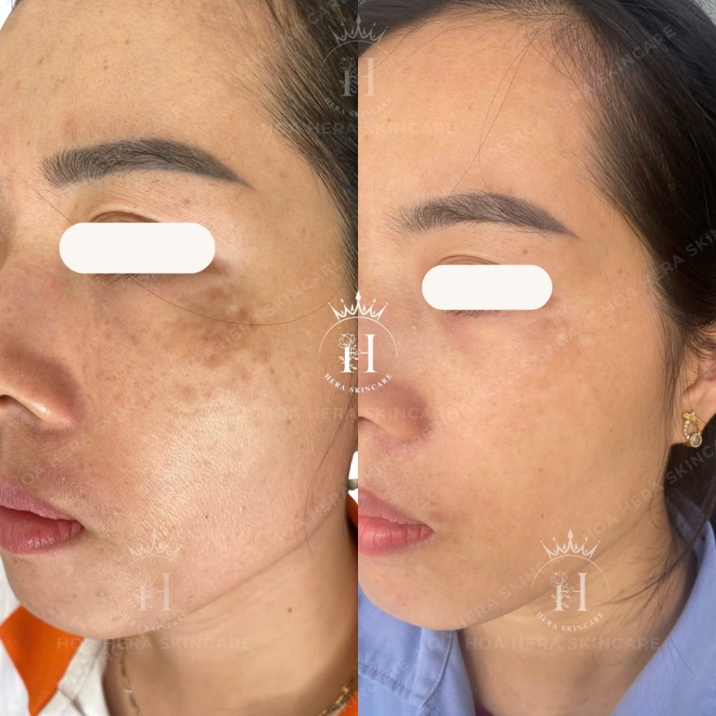 hình ảnh feedback là cái khách hàng cần nhất để đưa ra quyết định có nên chọn spa làm đẹp không