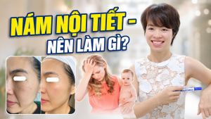 NÁM NỘI TIẾT SAU SINH NÊN LÀM GÌ