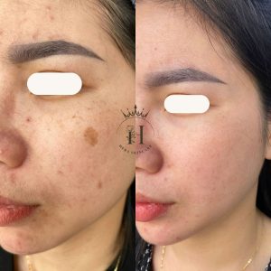 lầm tưởng chăm sóc da nào cũng cùng 1 phương pháp giống nhau