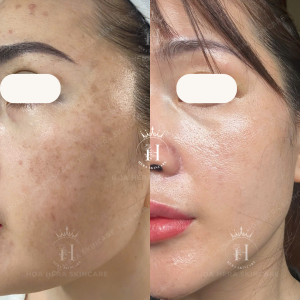nám đậm hơn không phải mỗi vì bạn ra ngoài mới có thể đậm hơn đâu
