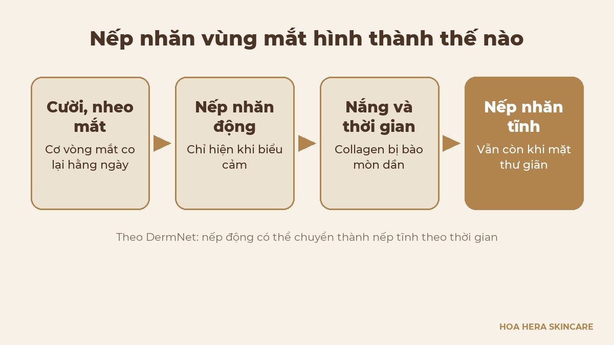 Sơ đồ quá trình nếp nhăn vùng mắt chuyển từ nếp nhăn động sang nếp nhăn tĩnh